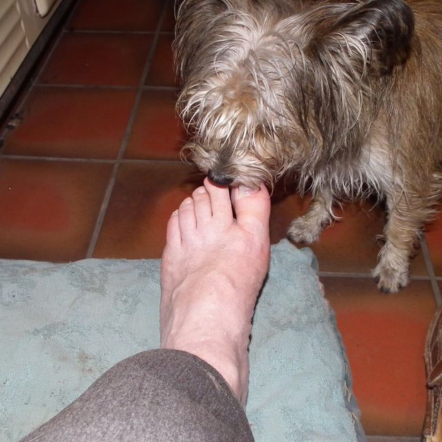 Bad toe 2.jpeg