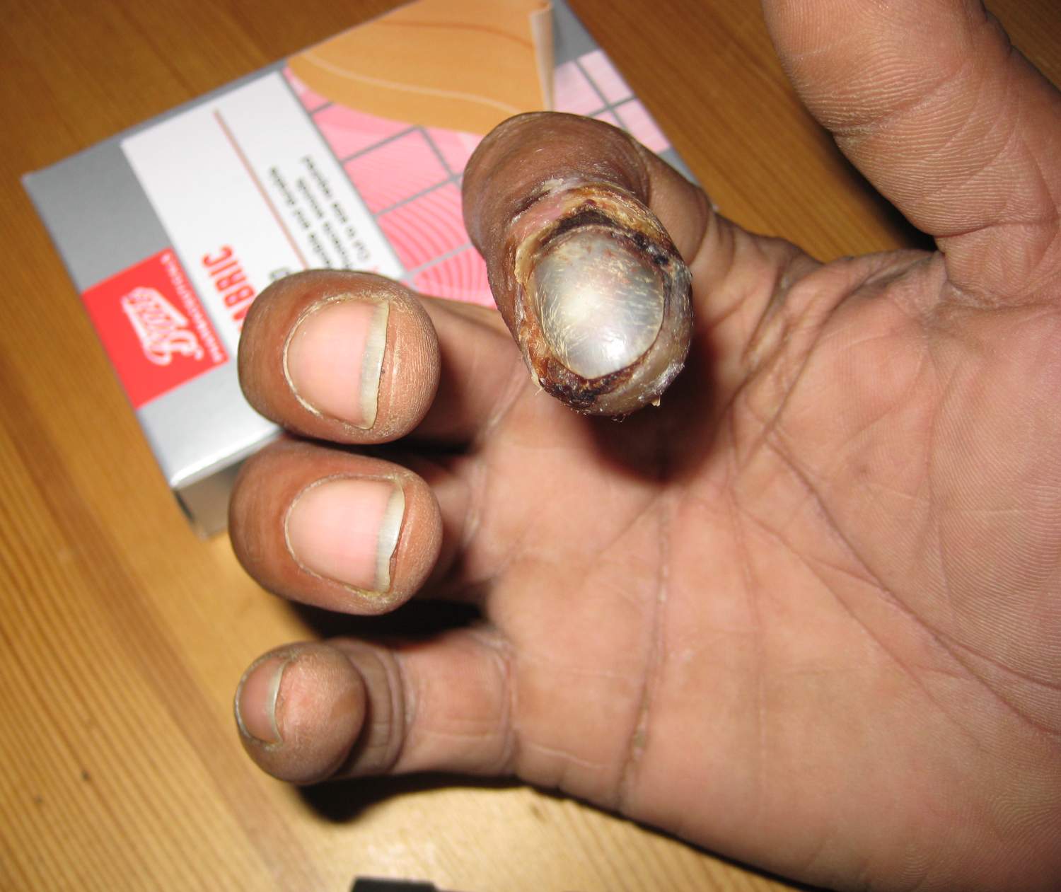 Finger.JPG