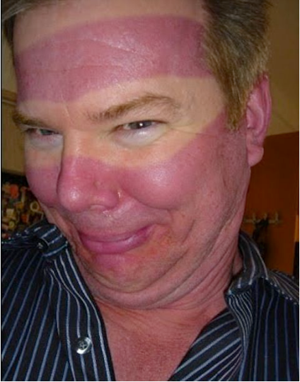 FireShot Capture 012 - sunburn glasses mark - Google Search - www.google.com.png