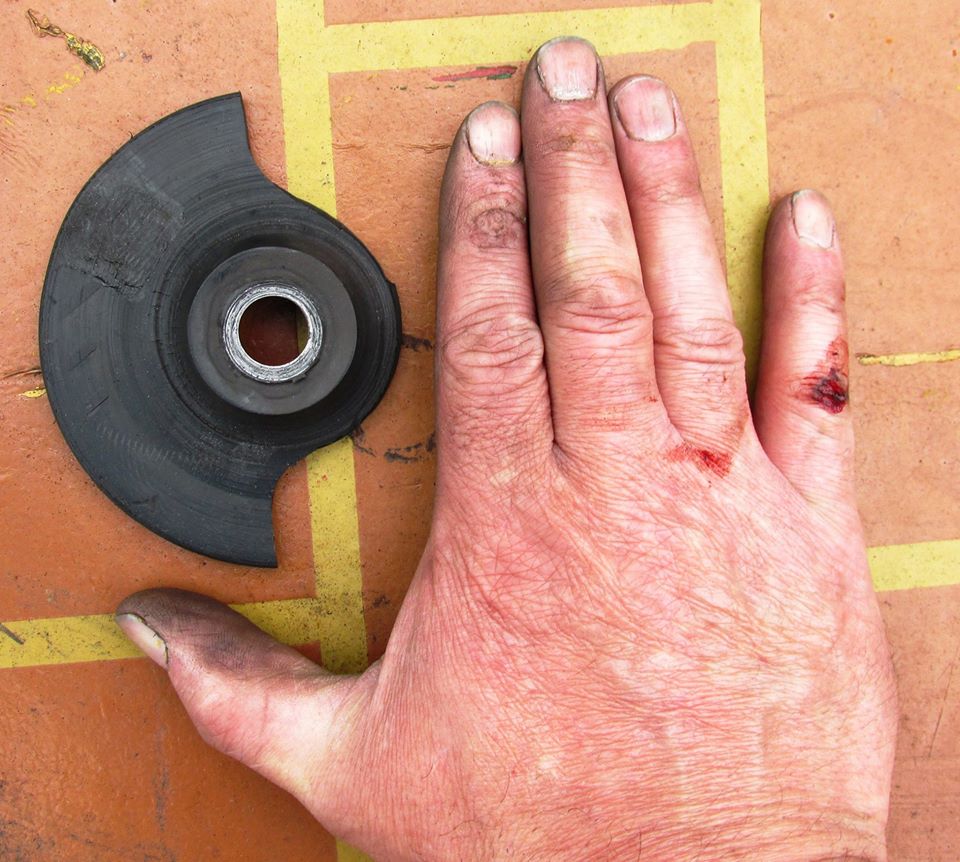 grinder accident.jpg