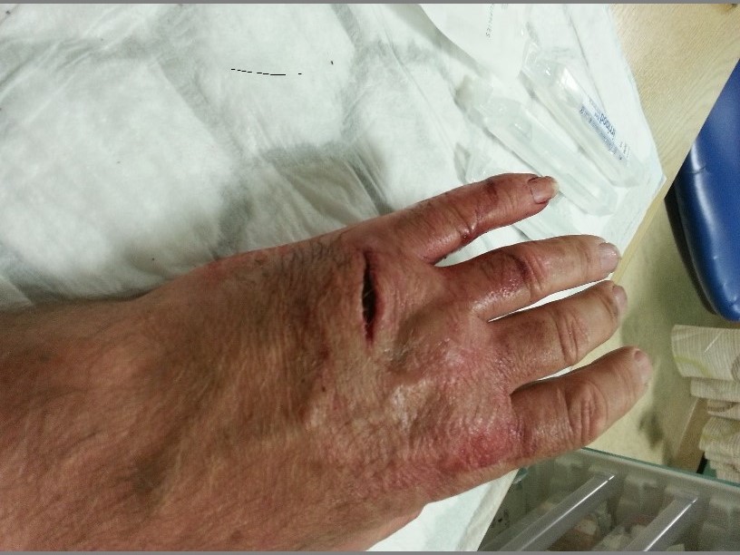 Hand.jpg