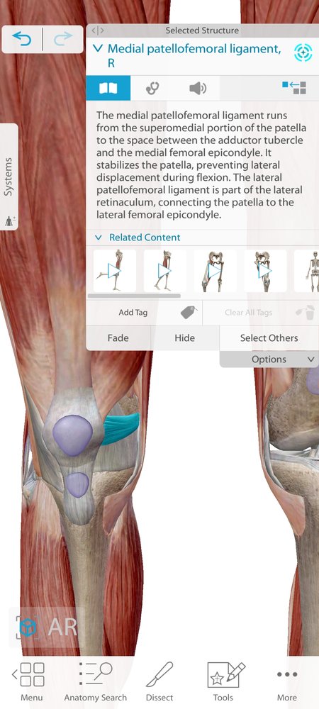 Screenshot_2023-08-07-20-38-25-742_com.visiblebody.atlas.jpg