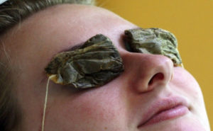 tea-bags-eye-treatment-flash-burn-300x185.jpg