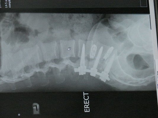 bones1.jpg