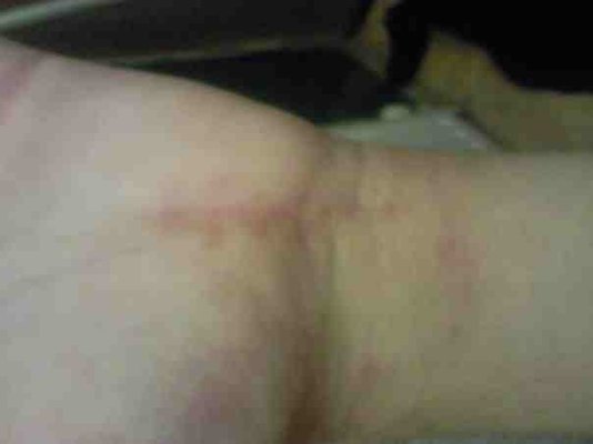 bottom wrist.jpg