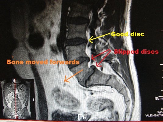 badback1c.jpg