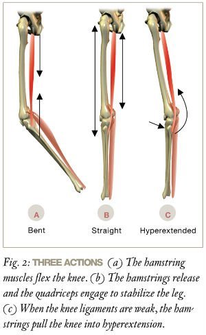 Sore_Hamstrings_2-677fa1065019161fa1da4693823bc6b2.jpeg