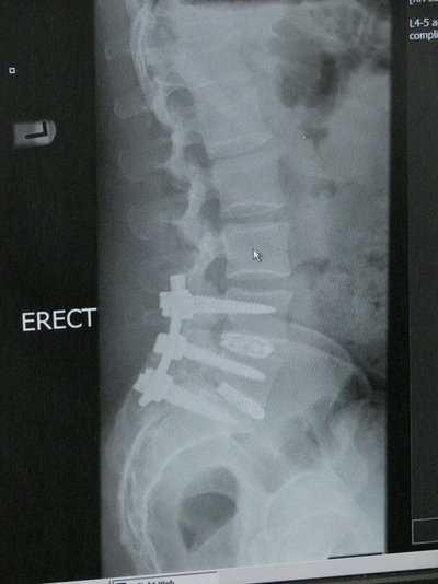 bones1a.jpg
